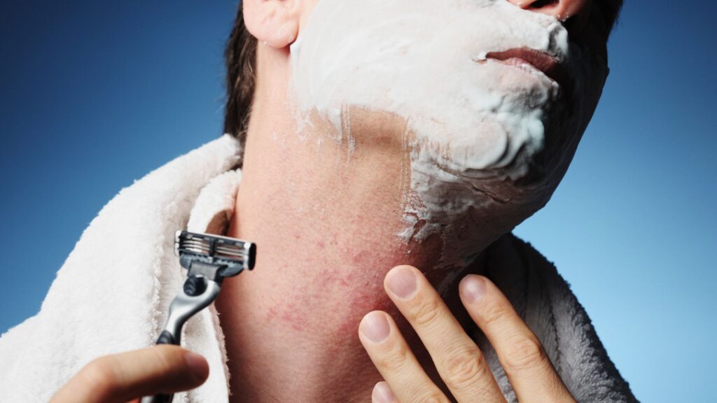 how-to-prevent-treat-razor-bumps-barber-rash-blog-by-xotics