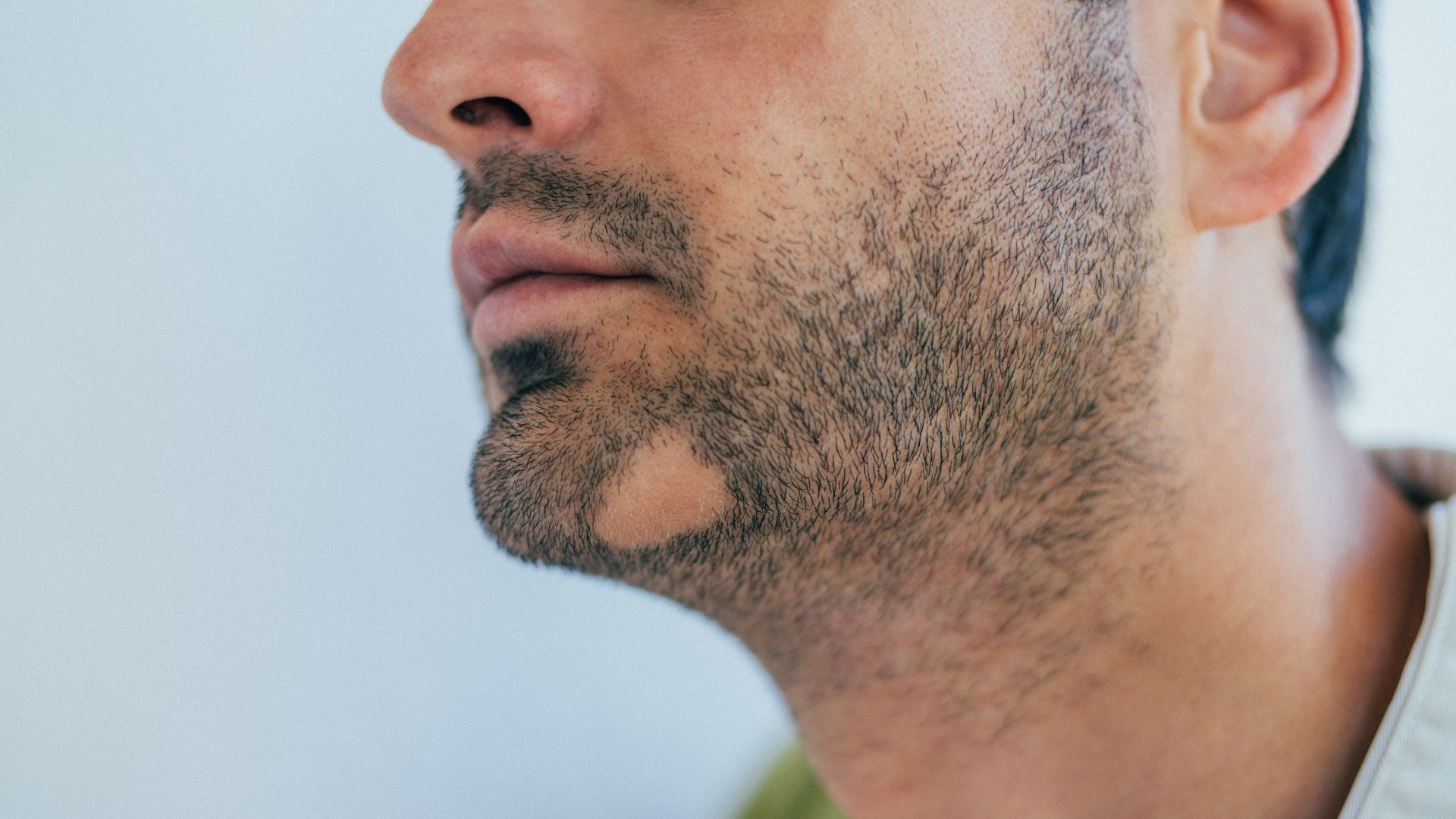 How to Speed Up Facial Hair Growth for a Full Beard